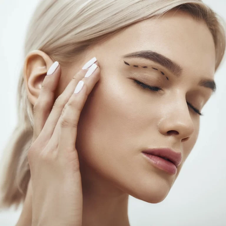 Blefaroplastia Blefaroplastia