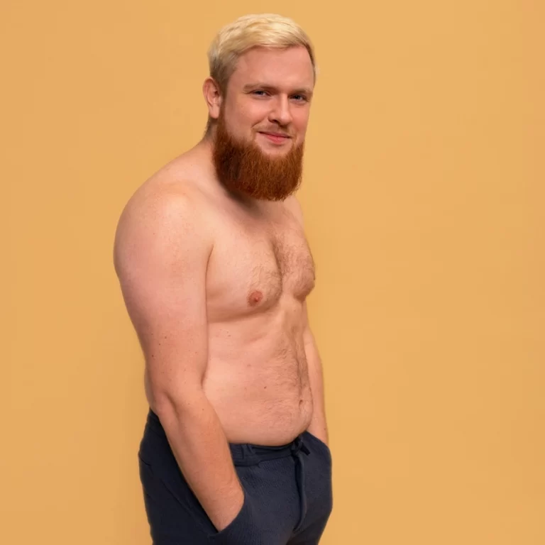 Ginecomastia masculina